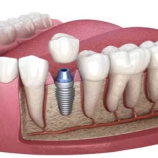 estetica dental